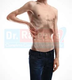 emaciated deutsch|emaciated body.